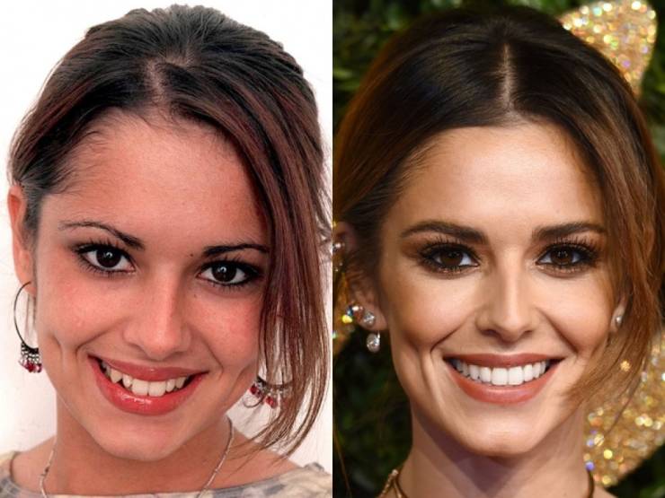 Zac Efron And Other Celebs Who Used To Have Way Different Teeth Zac Efron And Other Celebs Who Used To Have Way Different Teeth