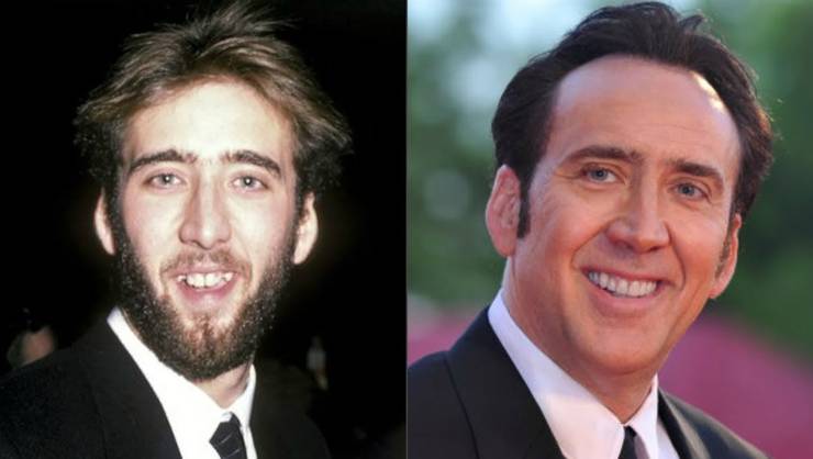 Wallpaper Zac Efron And Other Celebs Who Used To Have Way Different Teeth Free